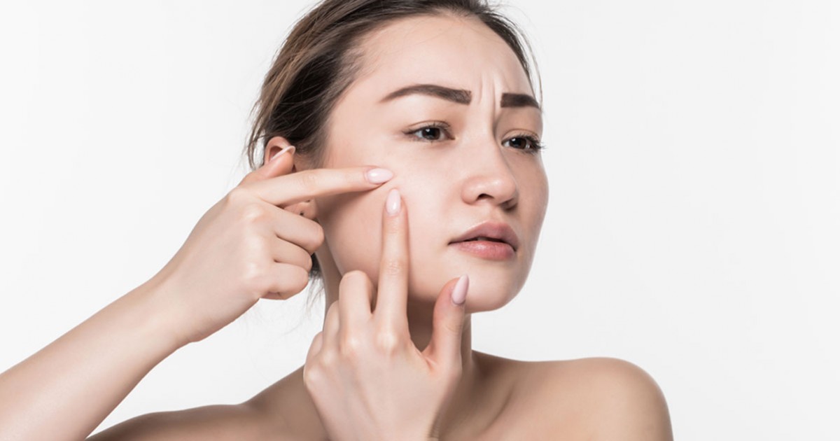 5 เจลแต้มสิว ที่คนรักผิวต้องมี