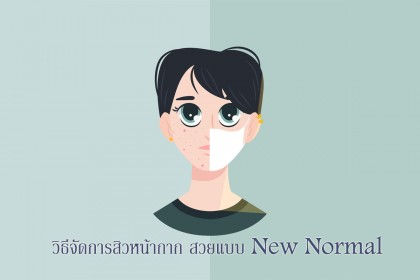 วิธีจัดการ สิวหน้ากาก สวยแบบ New Normal 