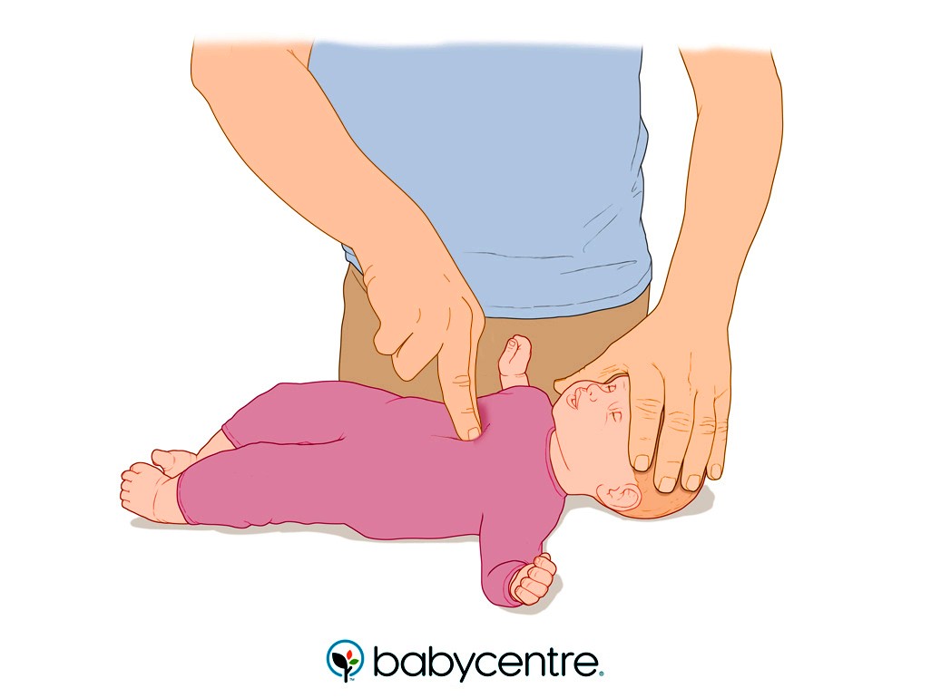 วิธีปฐมพยาบาล ลูกสำลักอาหาร หรือมีสิ่งแปลกปลอมติดคอ อุบัติเหตุที่อันตรายถึงชีวิตได้