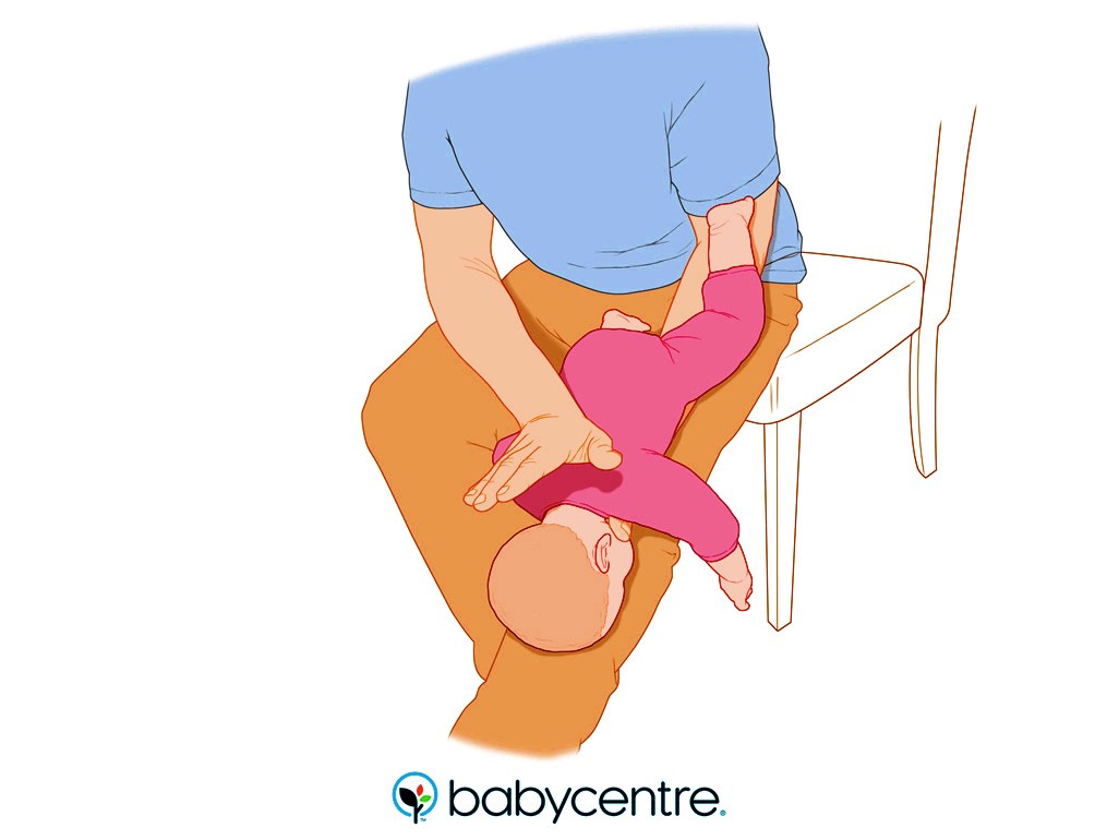 วิธีปฐมพยาบาล ลูกสำลักอาหาร หรือมีสิ่งแปลกปลอมติดคอ อุบัติเหตุที่อันตรายถึงชีวิตได้